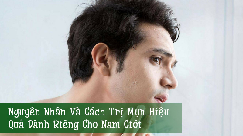 Nguyên-Nhân-Và-Cách-Trị-Mụn-Hiệu-Quả-Dành-Riêng-Cho-Nam-Giới