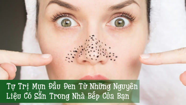 Tự-Trị-Mụn-Đầu-Đen-Từ-Những-Nguyên-Liệu-Có-Sẵn-Trong-Nhà-Bếp-Của-Bạn (1)